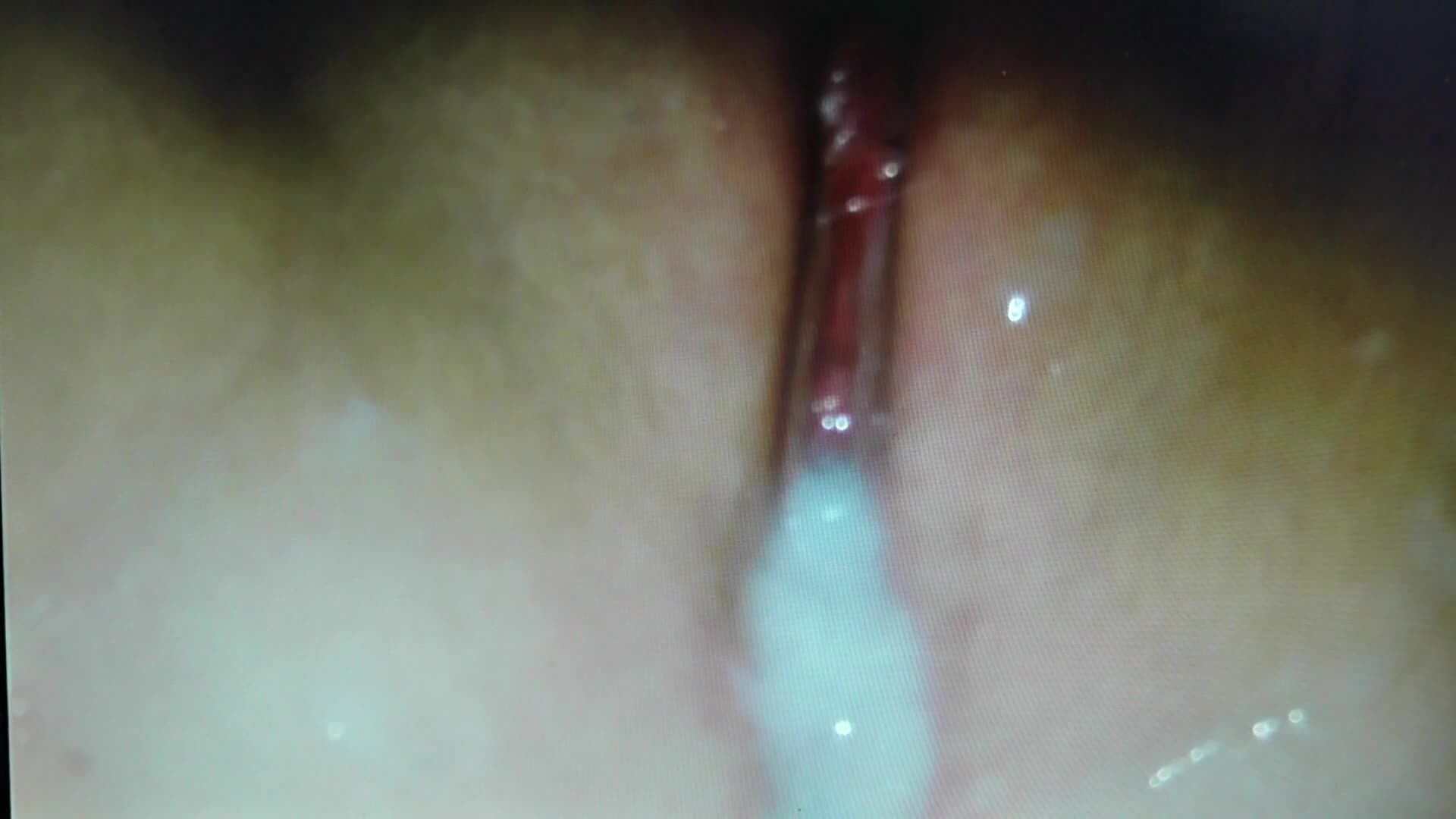 幼幼深夜被养父操逼内射逼上射满了精液黏糊糊的视频